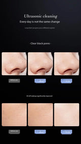 Blackhead Remover Blackhead Cleaning Pore Shrinking Beauty Device Dead Skin Acne Scalper Facial Pore Cleanser